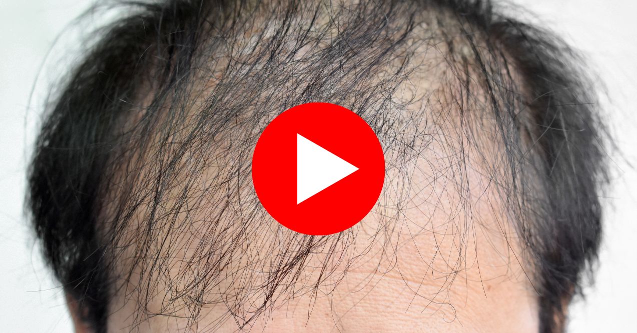 Amazing Find: The Hair Growth ‘Restart Button’